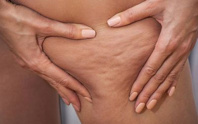 Les 5 bonnes raisons de faire un Drainage Lymphatique